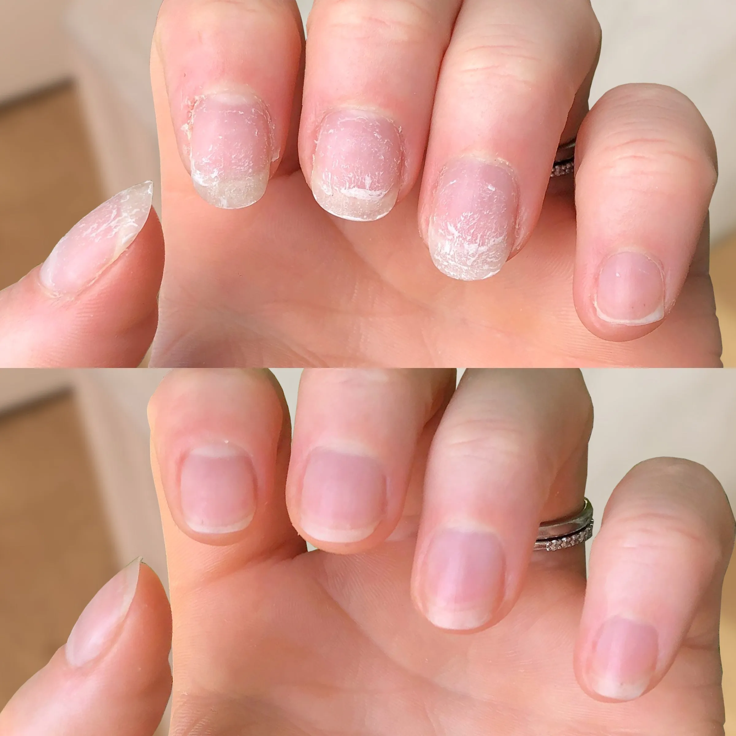 Ultimate Nail Rescue