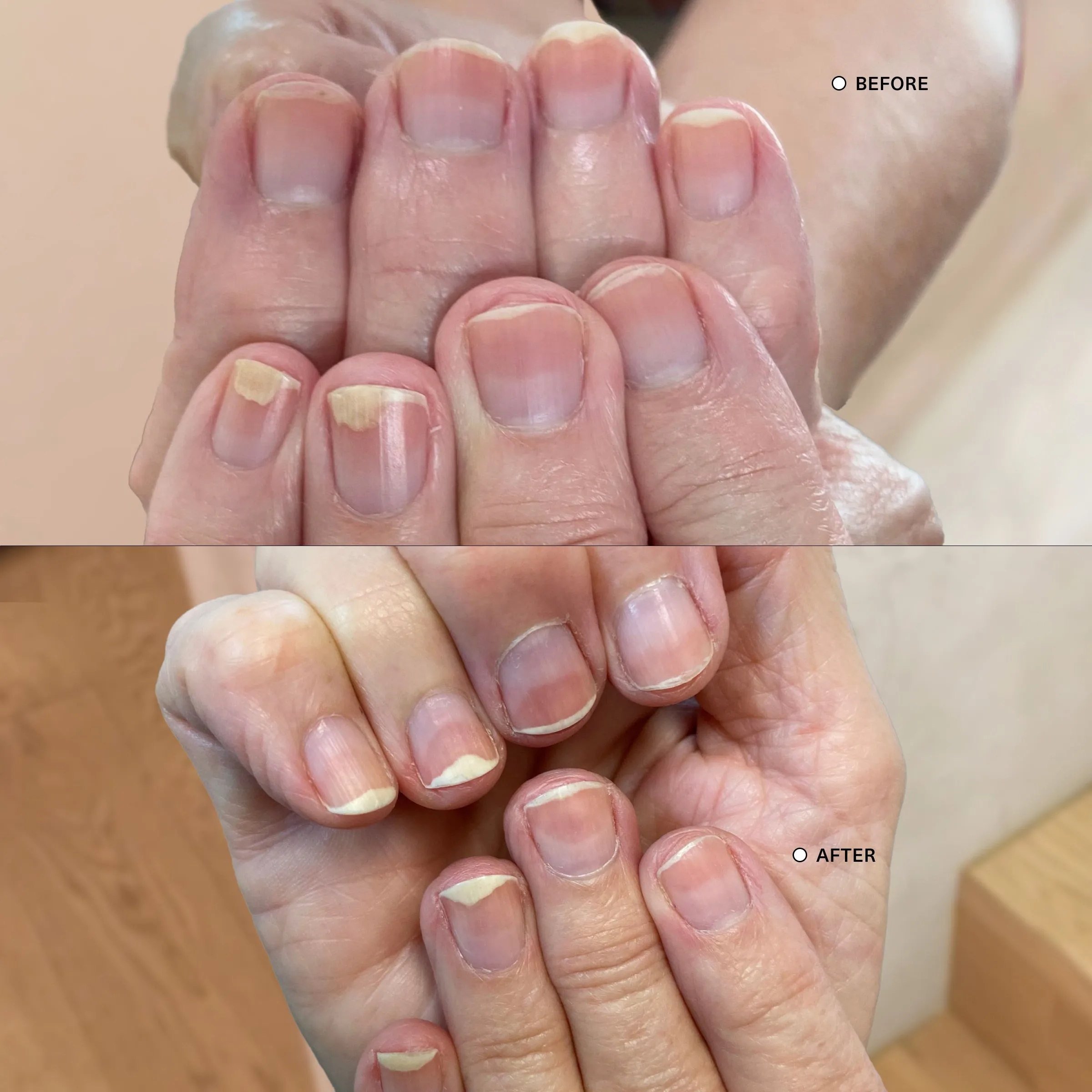 Ultimate Nail Rescue